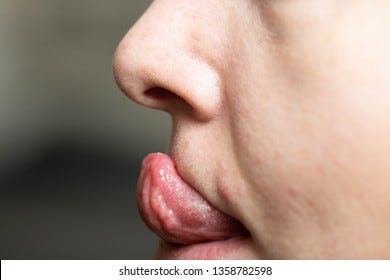 Gorlin Sign Ability Touch Tip Nose Stock Photo 1358782598 | Shutterstock