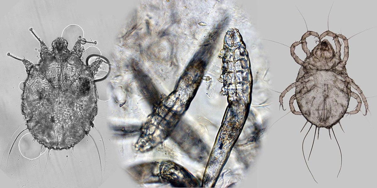 Ungex | Demodex Mite On Human Skin, The Comprehensive Guide