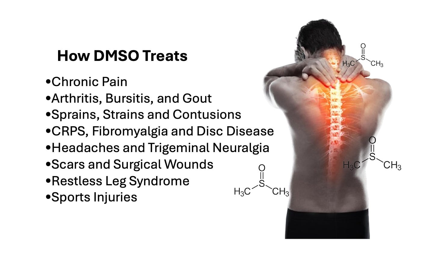 DMSO is a Miraculous Therapy for Chronic Pain and Musculoskeletal Injuries