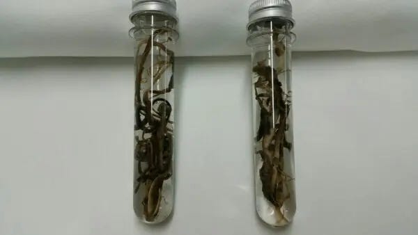 Two vials of embalmed fibrous clots. "These would come out in one piece and be the shape of the artery. They are slowly growing in the arteries until they block them," Mr. O'Looney said. (Courtesy of John O'Looney)
