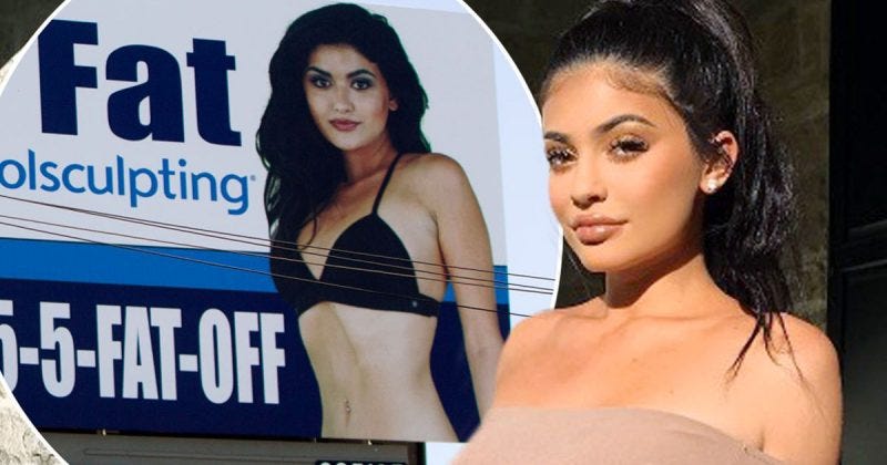 kylie jenner coolsculpting billboard