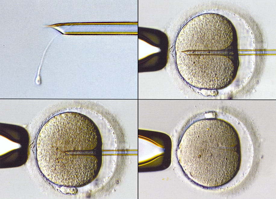 Intracytoplasmic Sperm Injection (ICSI) | IVF | UNC Fertility Intracytoplasmic Sperm Injection (ICSI) | IVF | UNC Fertility