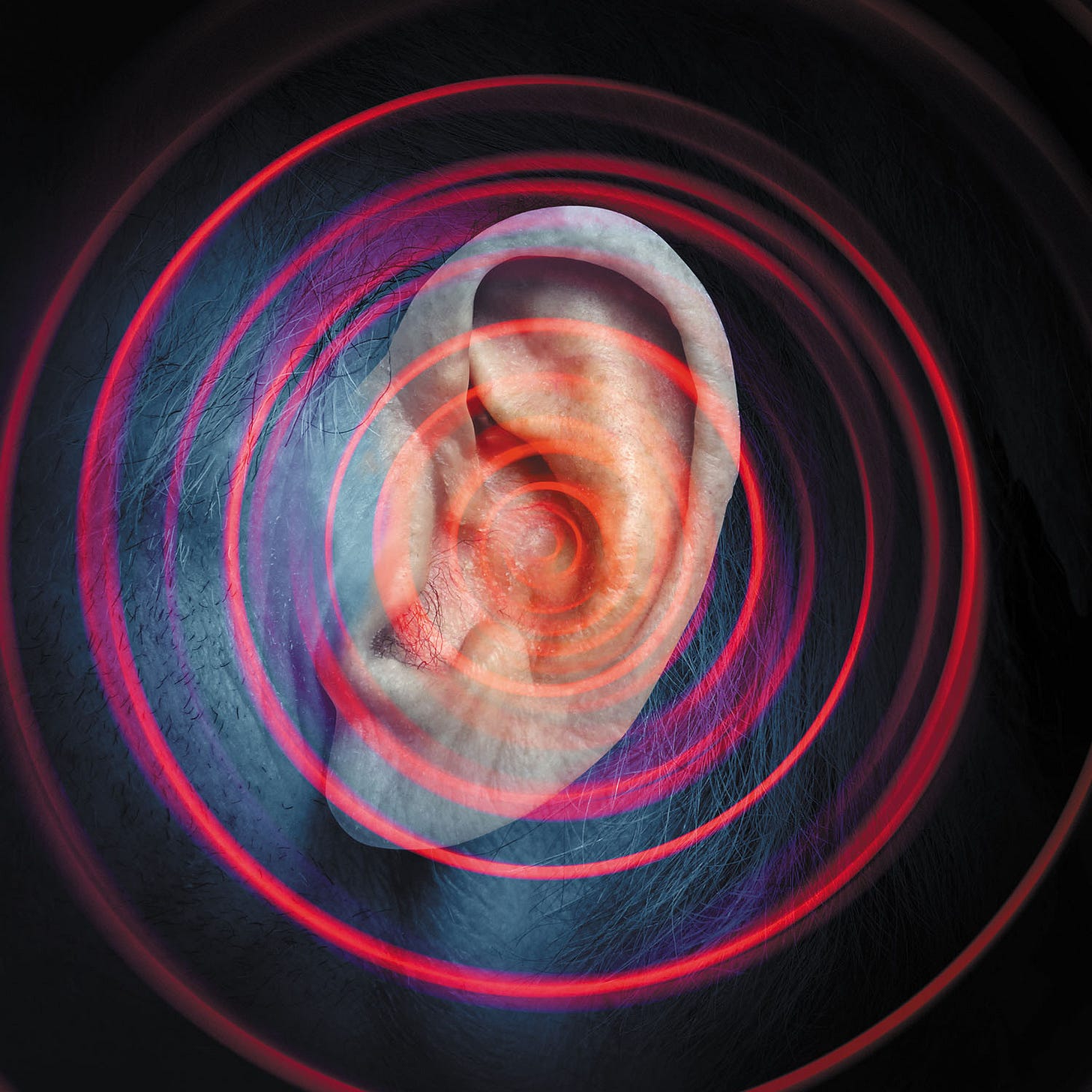 Lowering the volume of tinnitus - Harvard Health