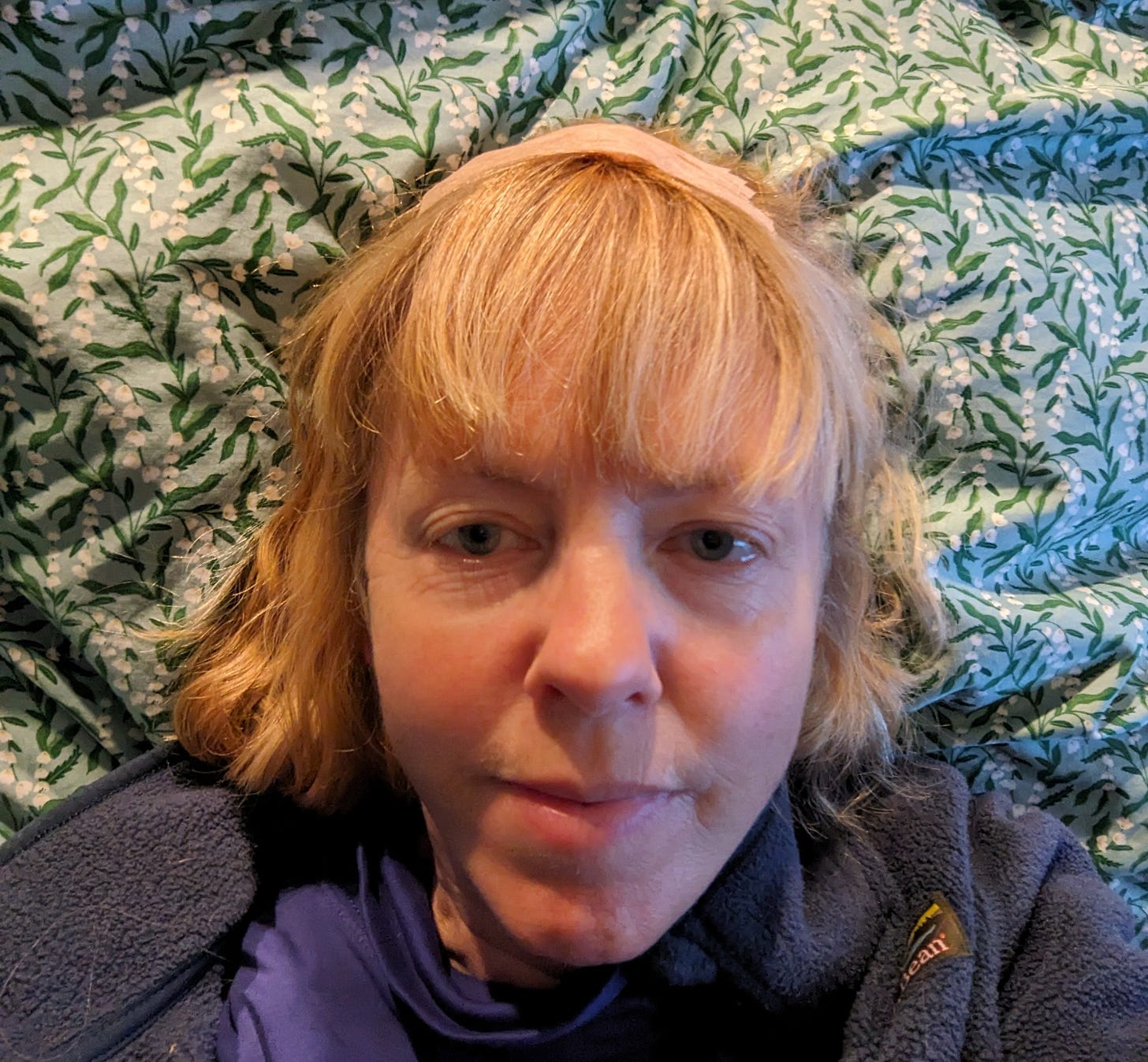 Author with small bandage on top of head