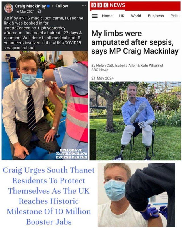 r/ChurchOfCOVID - My limbs were amputated after sepsis, says MP Craig Mackinlay