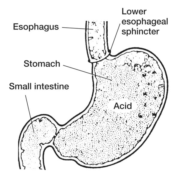 Lower esophageal sphincter - Media Asset - NIDDK