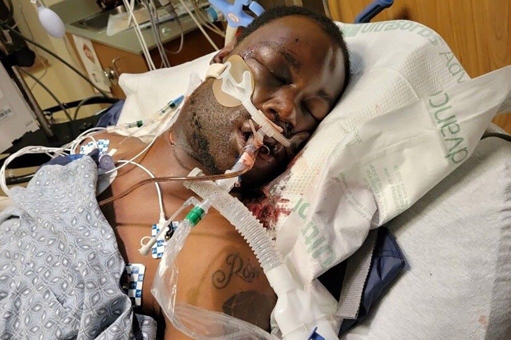 A picture of Tyre Nichols in the hospital before he died.