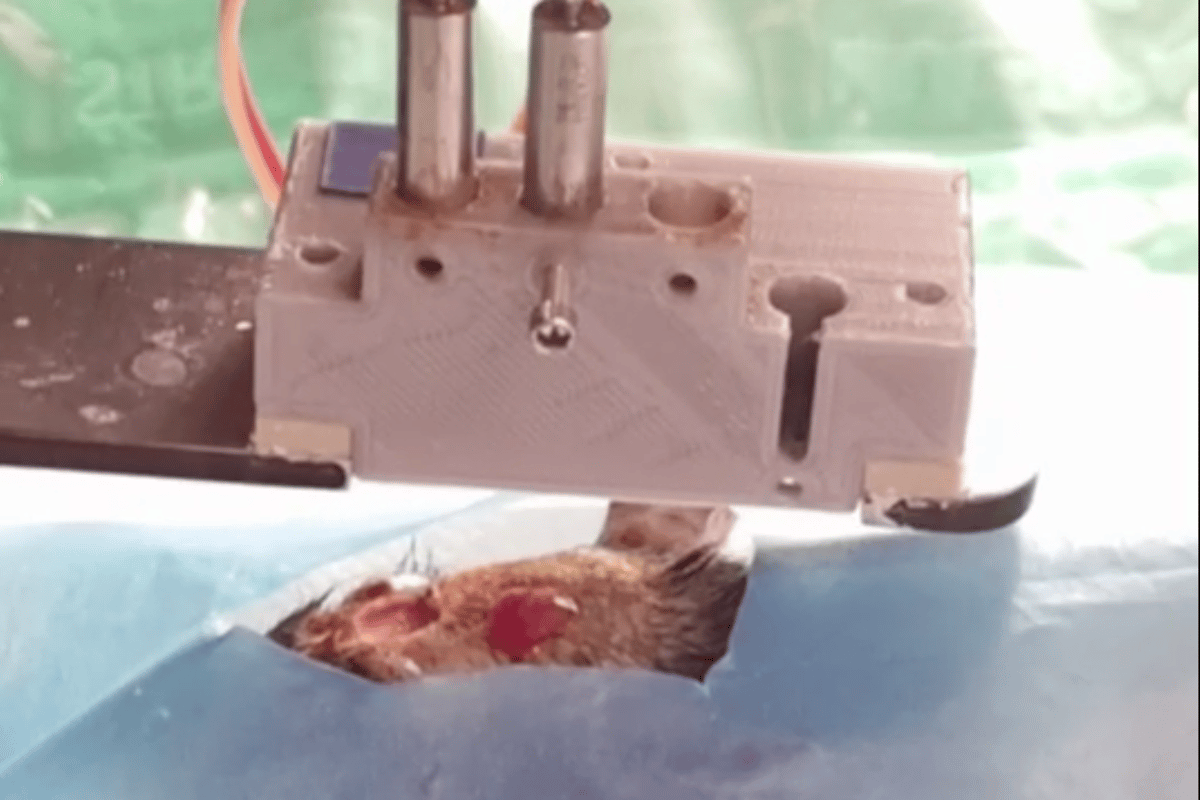 Full-thickness living skin was 3D printed during surgery to correct a signficant skin injury