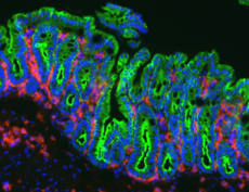 whiteblood cells calle dmacrophages (red) in the gut with the gut epithelial cells stained green. Cell nuclei are blue