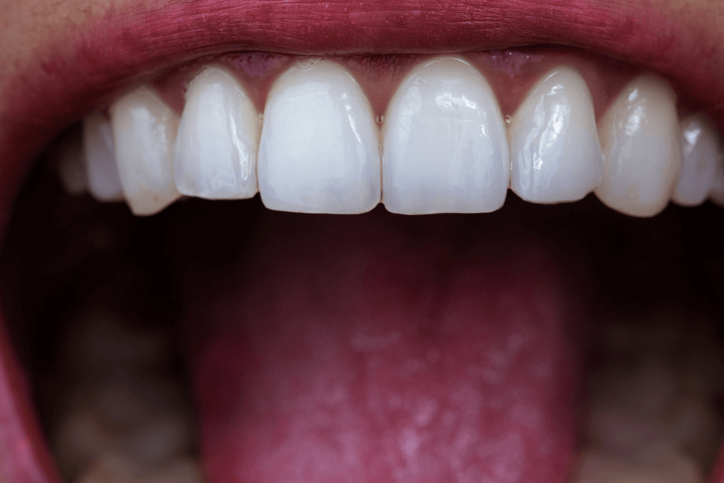 How Many Teeth Do Humans Have | Number Of Teeth