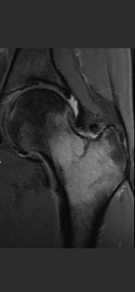 A close-up of a knee joint

Description automatically generated