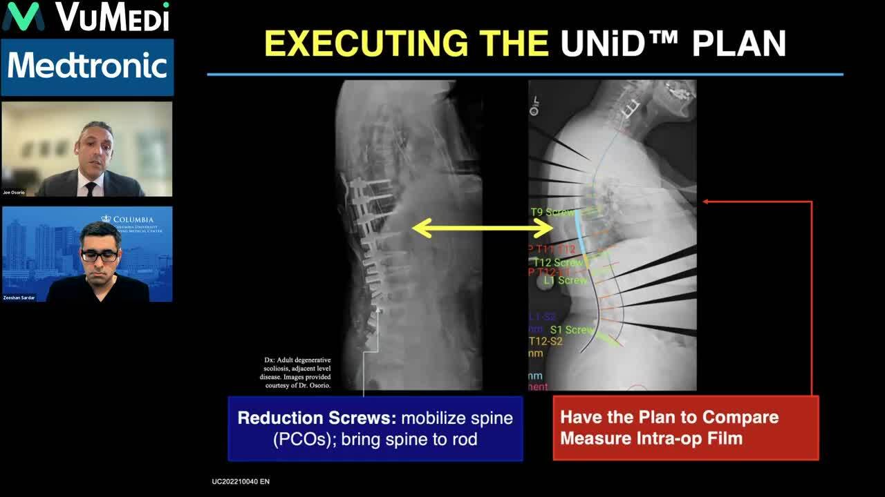 Enhancing the Approach to Spine Surgery with Mazor™ System & UNiD™ ASI  Technology | VuMedi