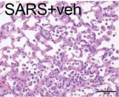 Comparison of lung tissue in control (top), untreated Covid (middle), and Covid treated with idroxonil.