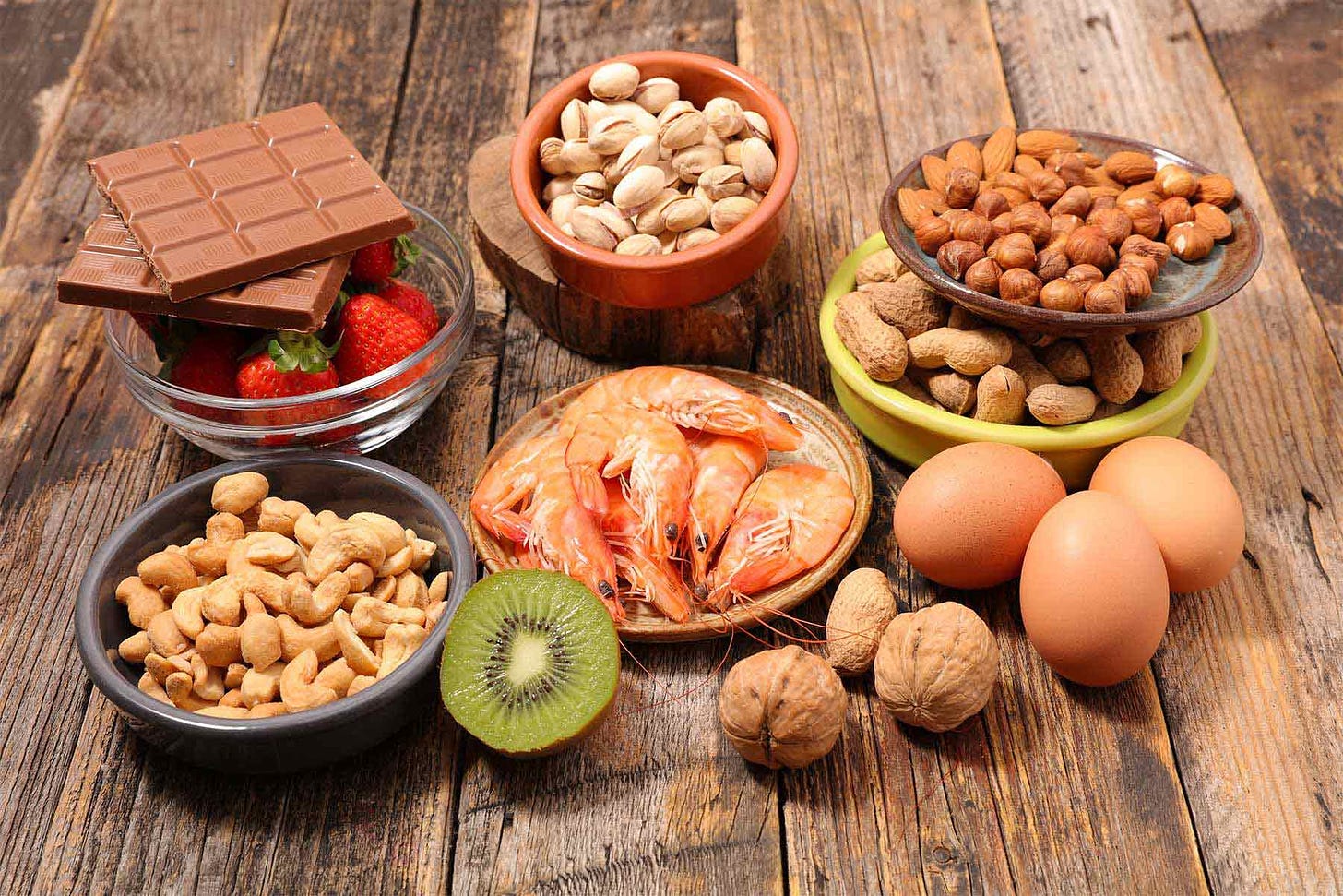 Train Your Body towards Tolerance of Food Allergens - The Waiting Room