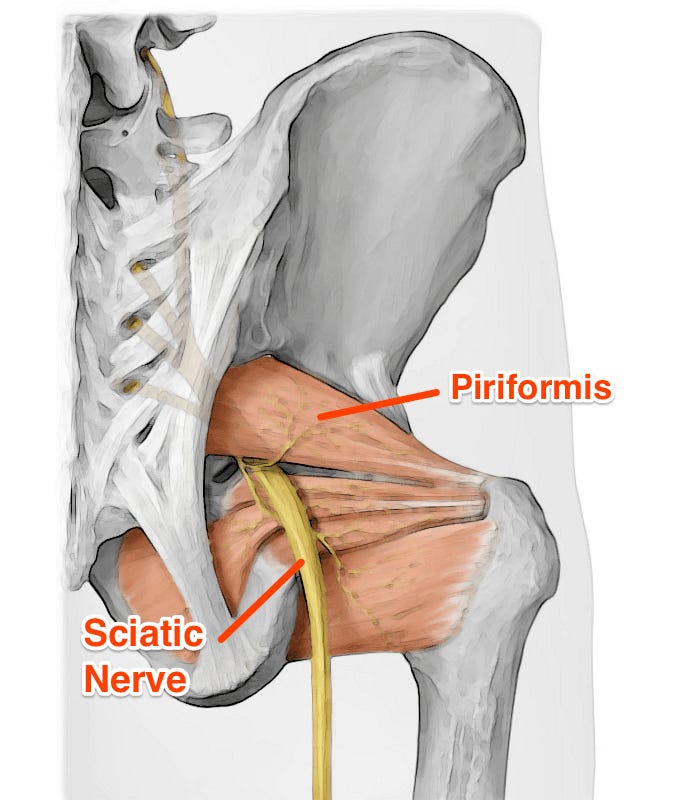 piriformis as source of pain with deep gluteal syndrome