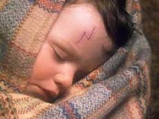 Harry Potter's scars | Harry Potter Wiki | Fandom