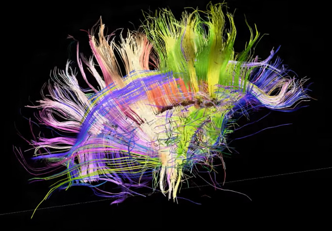 Screenshot of the Human Brain from “Brain wiring a no-brainer” in Collins (2010)