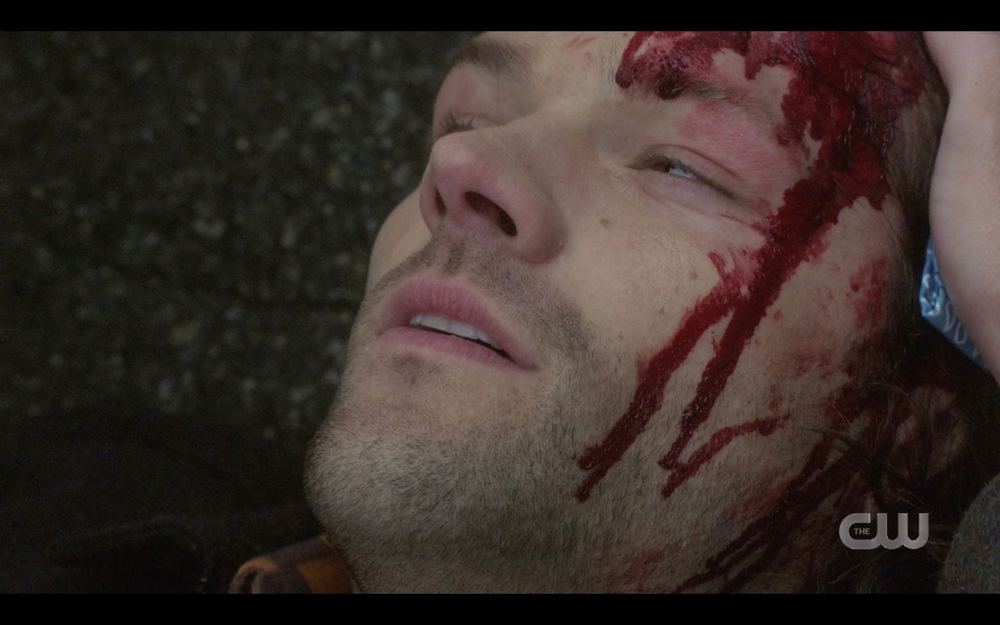 Dean caressing Sam Winchesters bloody head SPN 14.17