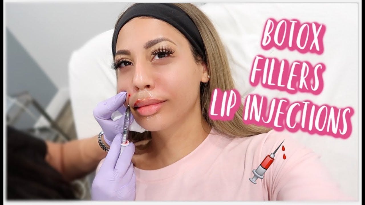 ENTIRE FACE OF BOTOX, FILLER & LIP INJECTIONS - YouTube