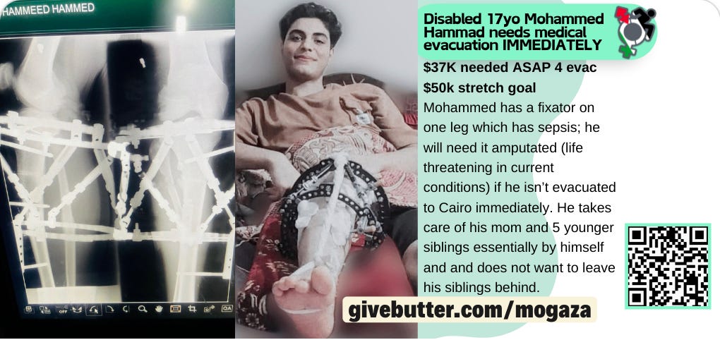 A graphic with black text on a white and seafoam background that says : Disabled 17 year old Mohammed Hammad needs medical evacuation immediately! To the left of the text is a photo of Mohammed Hammad laying down with his right leg propped up and images of an x-ray showing a lot of metal pins in a leg. His leg has a Ilizarov apparatus, a metal fixator that holds pins in his leg (so they are both external and internal, and are easily infected). He is wearing a brown shirt and is smiling. There are two QueerCrip symbols on the graphic that are filled in with pal-eh-steinian flags.