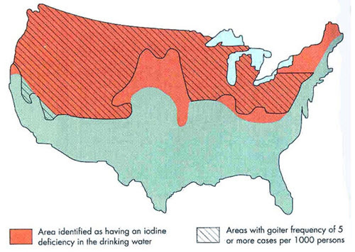 US Iodine map 