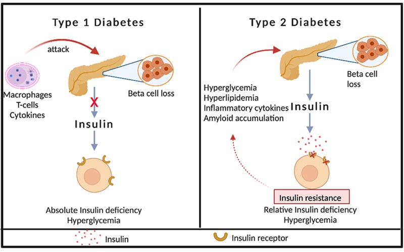 Type 1 and 2 diabetes