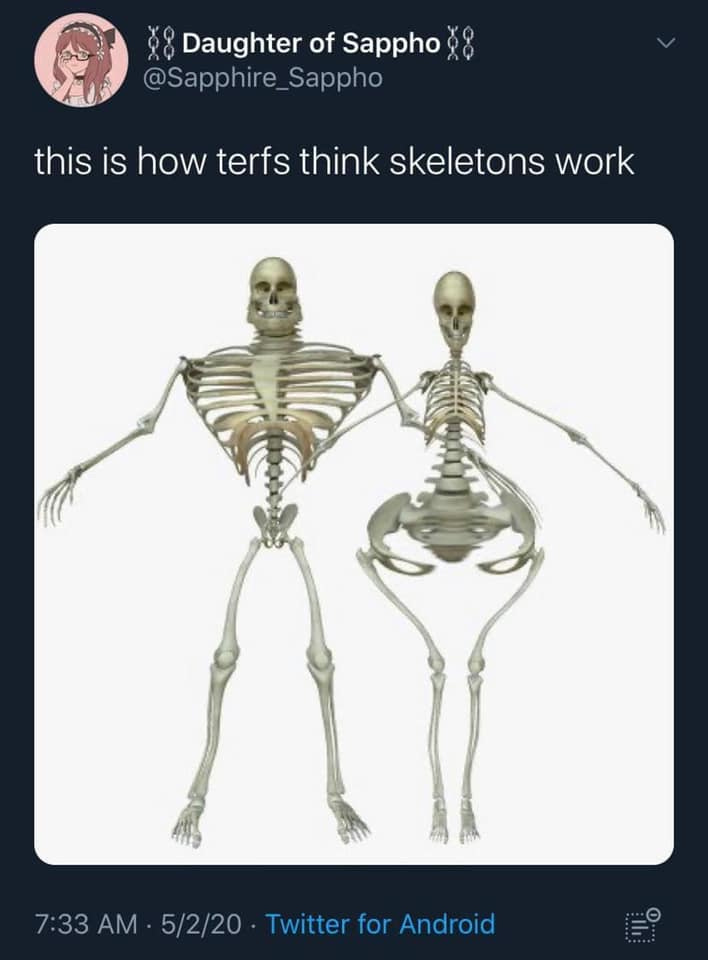 r/traaaaaaannnnnnnnnns - a couple of skeletons standing together r/traaaaaaannnnnnnnnns - a couple of skeletons standing together