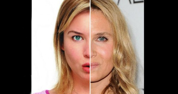 renee zellweger celebrities who havent aged well 2015