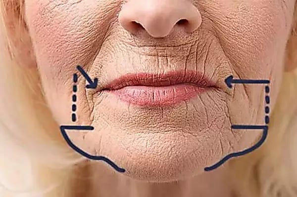 Dermatologist Begs Americans To "Fill In" Wrinkles With This Tip (Every Morning)