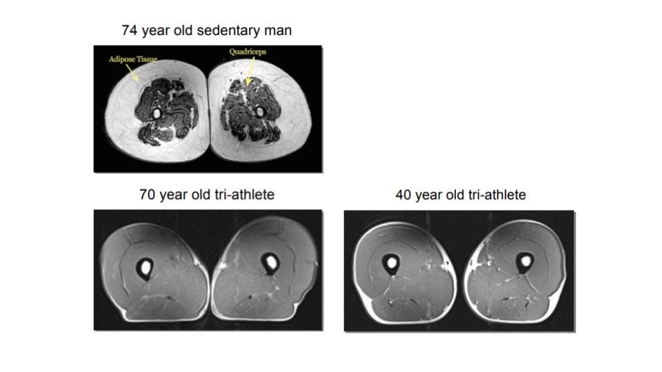 Longevity Briefs: High Level Athletes Lose Little Muscle After Their 40s -  Gowing Life