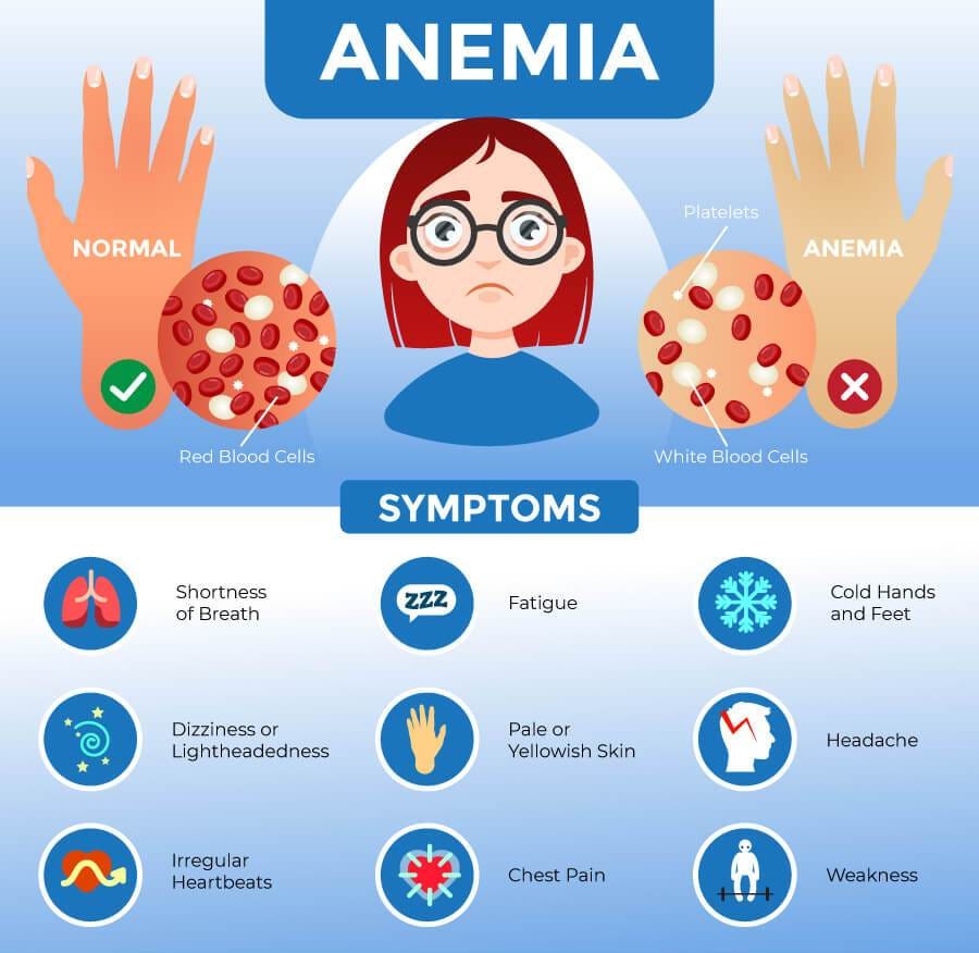 Consult for Anemia - My Nature Coach