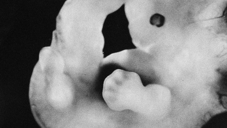 Image: Lennart Nilsson's A Child is Born