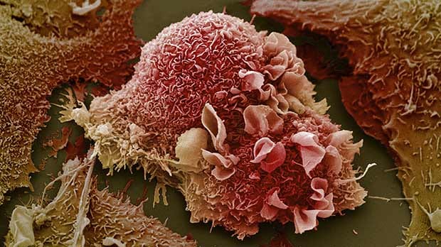 Science Surgery: 'How do cancer cells remain dormant for many years?'