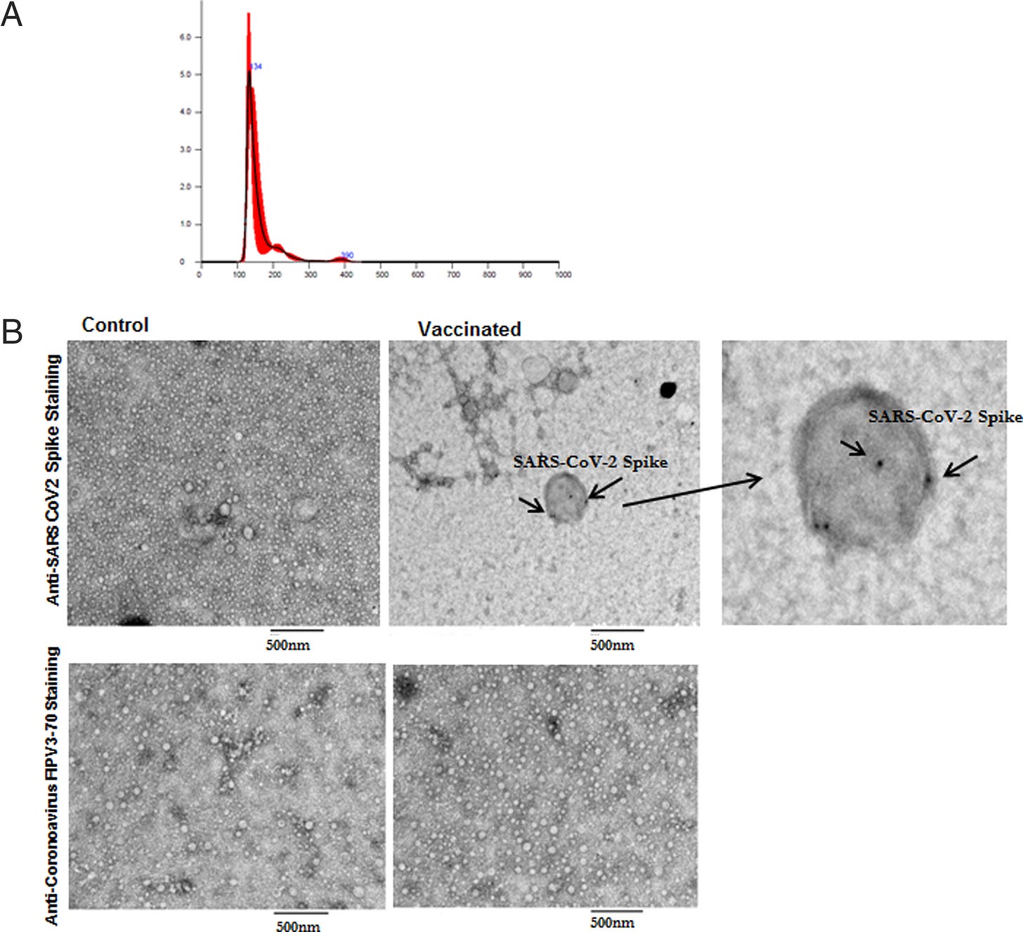 (A) Representative NanoSight image for exosomes from vaccinated individuals with mean and median sizes (black thin line in the graph indicates the three measurements of the same sample, and red line is the average of all three lines). (B) Transmission electron microscopy images of SARS-CoV-2 spike Ag on exosomes from control exosomes from control and vaccinated individuals. Arrows indicate SARS-CoV-2 spike-positive exosomes. Right side, third image is the zoomed image of positive exosome from vaccinated sample (original magnification x 50,000). We have used anti-coronavirus FIPV3-70 Ab as negative control for both the samples.
