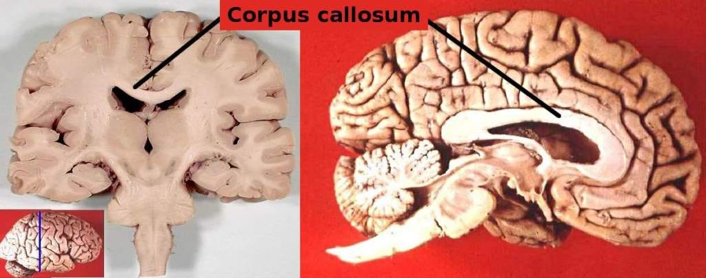 Corpus Callosum | Function, Etymology, Location & Anatomical Structure