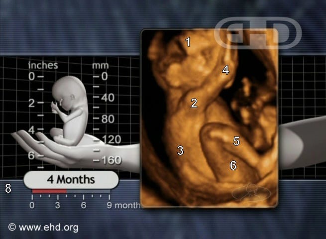 drawing of baby labeled four months beside ultrasound of four month baby kicking drawing of baby labeled four months beside ultrasound of four month baby kicking