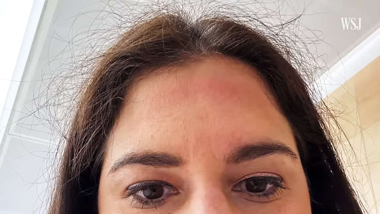Joanna Stern with a red mark on her face from wearing Apple Vision Pro