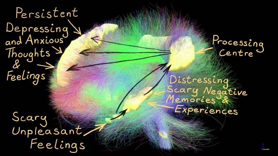 Is an Overactive Default Mode Network causing Anxiety & Depression?