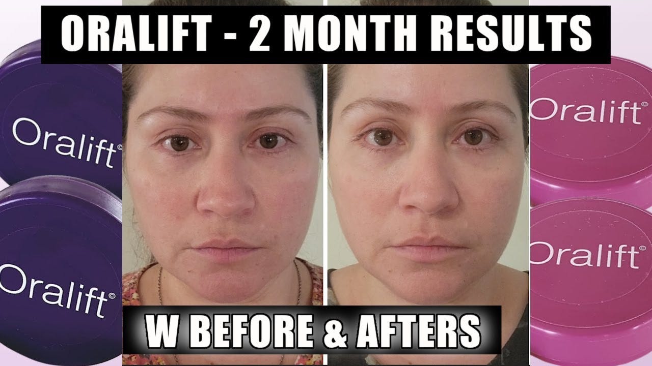 ORALIFT | 2 MONTHS RESULTS W BEFORE & AFTERS