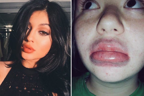 kylie jenner lips challenge no statement 2015 kris jenner