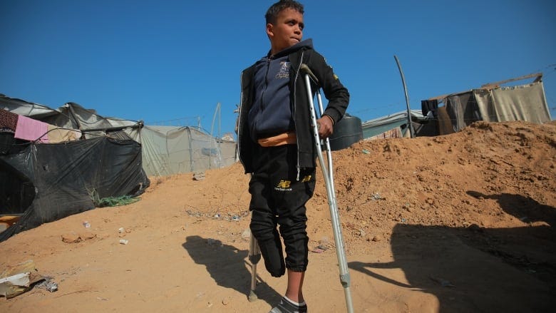A 12 year old boy is holding crutches. He's looking off to the side with a blank look on his face. He's standing in front of a shanty town of homes made of plastic bags and blankets in the Gaza strip. His right leg is amputated below the knee. He's wearing black sweatpants, a blue hoodie and a black jacket. 