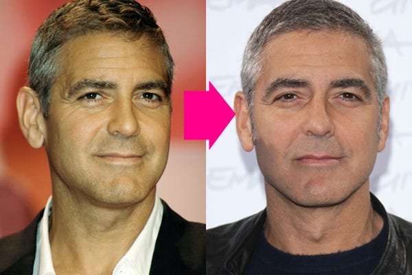 George Clooney Plastic Surgery Botox and Face Before and After - Celebrity  Before and After Plastic Surgery