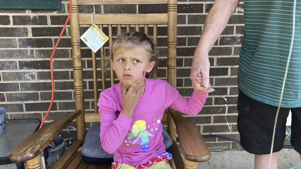 Kinsley White, 6, shows reporters a wound left on her face, Thursday, April 20, 2023 in Gastonia, N.C. A North Carolina man shot and wounded a 6-year-old girl and her parents after children went to retrieve a basketball that had rolled into his yard, according to neighbors and the girl's family — another in a string of recent shootings sparked by seemingly trivial reasons. (Kara Fohner/The Gaston Gazette via AP)
