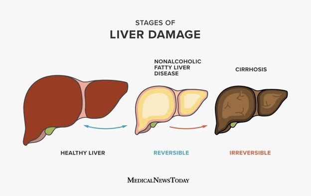 liver damage