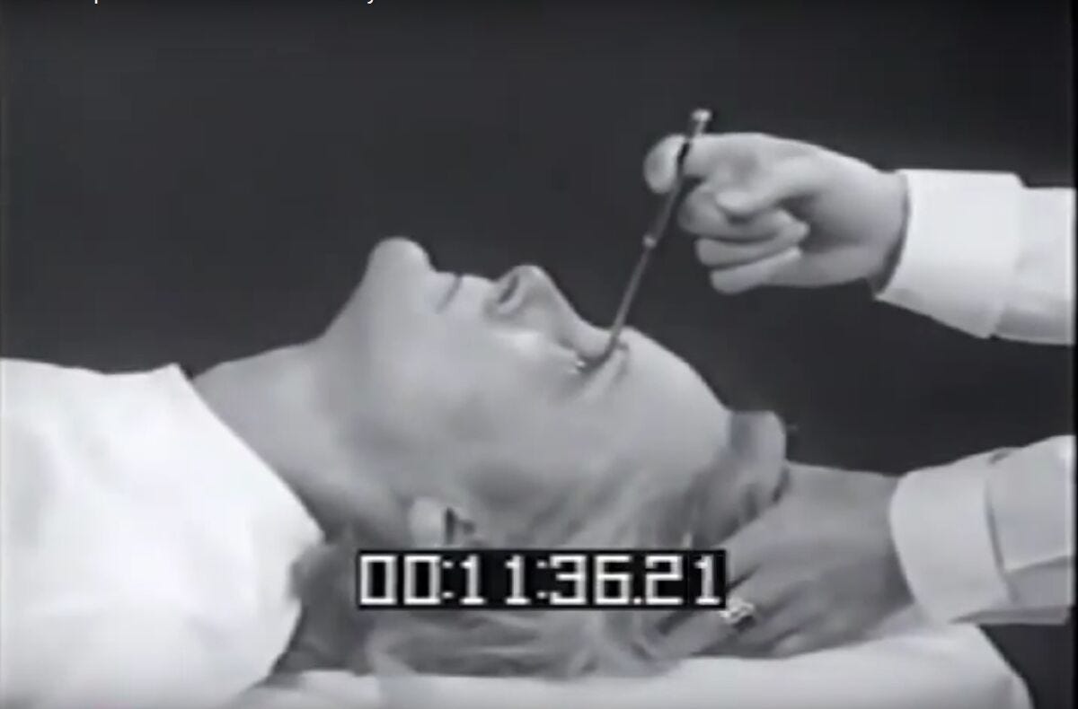 Indiana Medical History Museum - Lobotomy: Intentions, Procedures, Effects