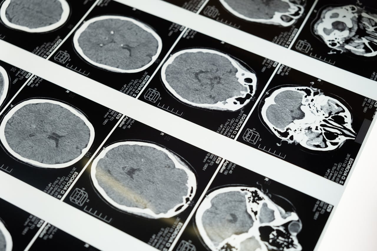 Image of brain scans. Photo by cottonbro studio