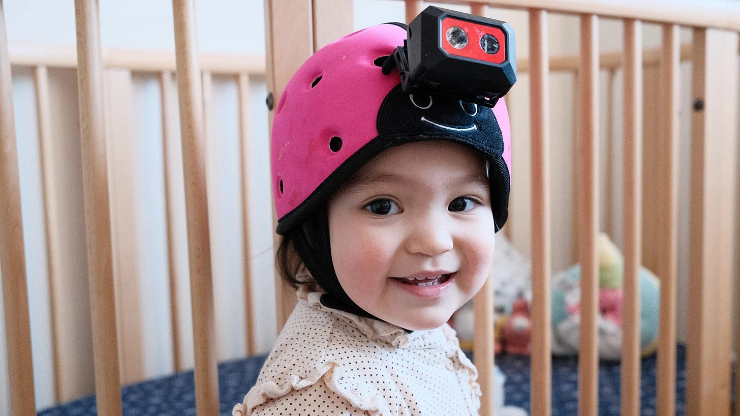 Photo of an 18mo baby wearing a head-mounted camera