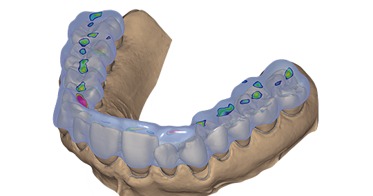 exocad Bite Splint (Perpetual Initial Purchase)