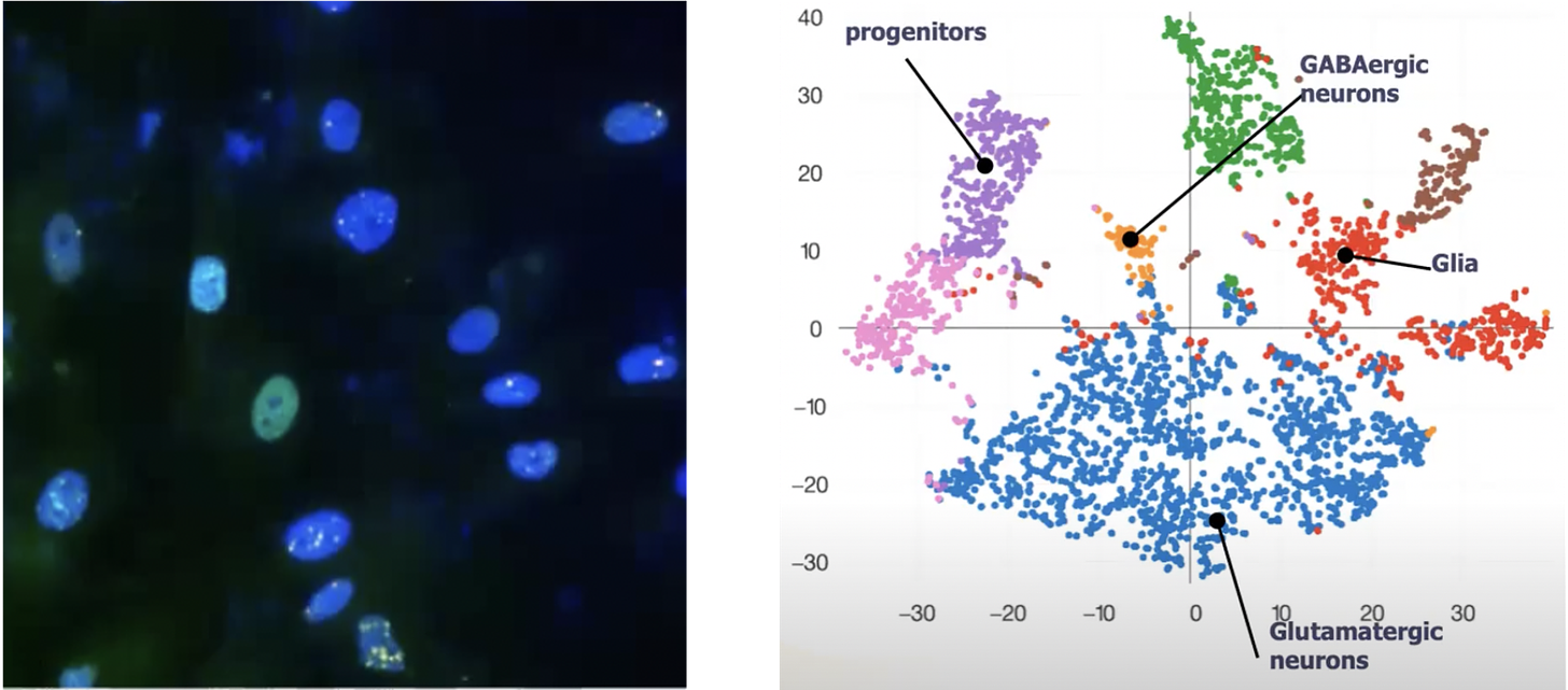 Microscopy image of nuclear staining of fibroblast cells and a t-SNE plot of data from cortical organiods.