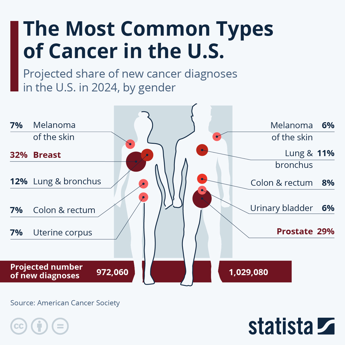 Chart: The Most Common Types of Cancer in the U.S. | Statista